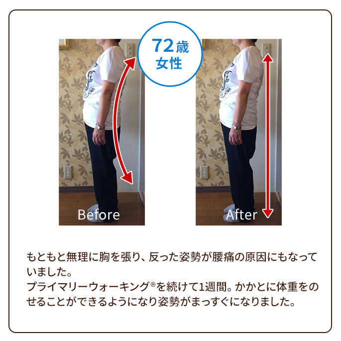 もともと無理に胸を張り、反った姿勢が腰痛の原因にもなっていました。プライマリーウォーキング(R)を続けて1週間。かかとに体重をのせることができるようになり姿勢がまっすぐになりました。